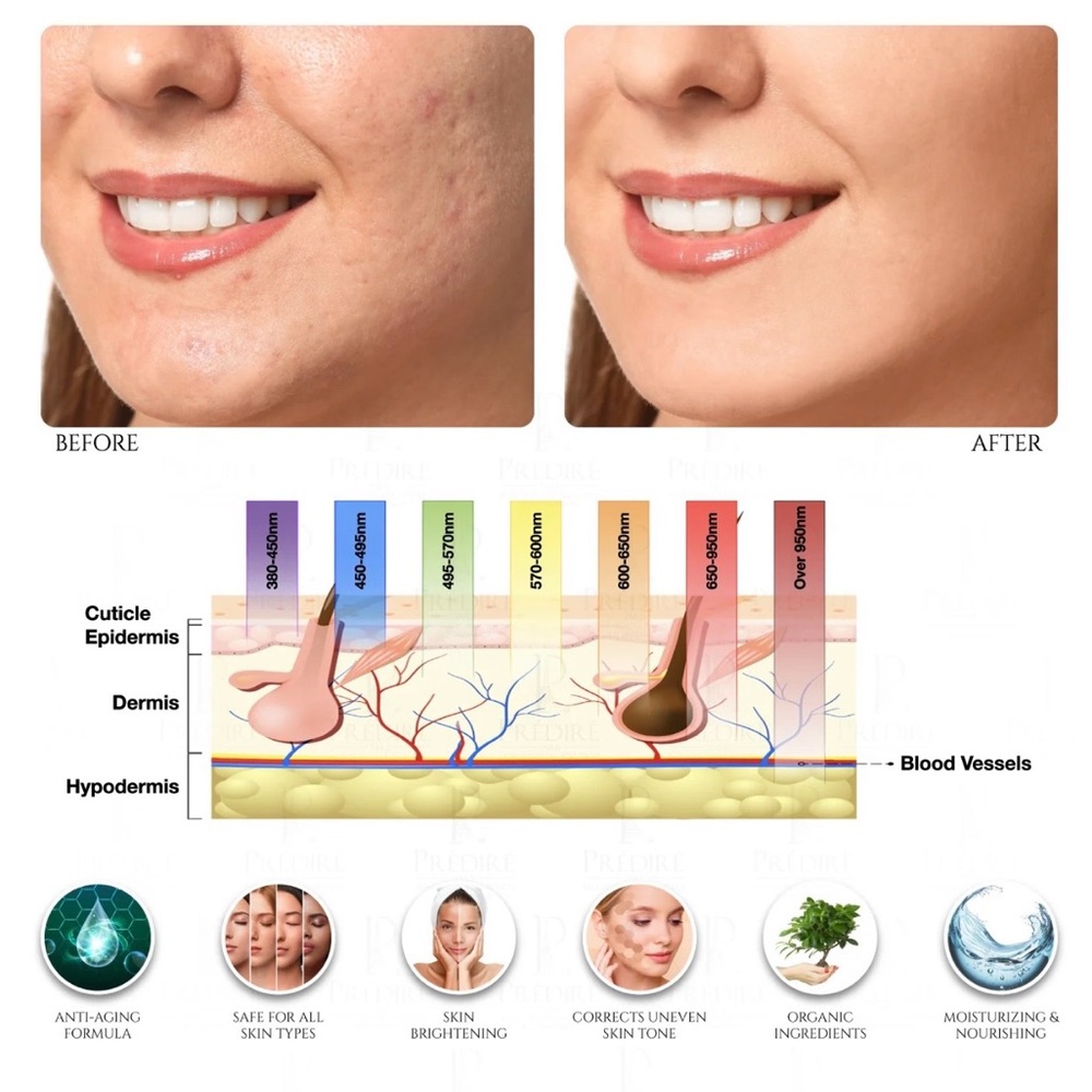 8 Element Multi-Purpose Skincare Mask Non-Surgical Solution LED Treatment - Picture 9 of 16
